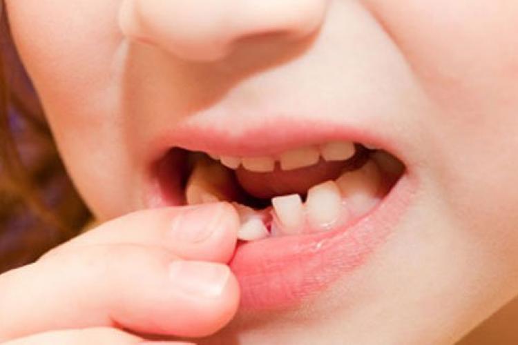 لق شدن دندان در طول درمان ارتودنسی