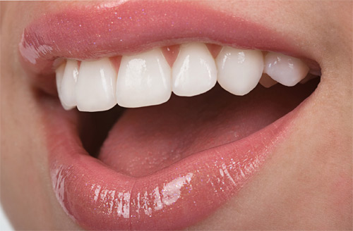 پر کردن دندان با کامپوزیت یا آمالگام ؟