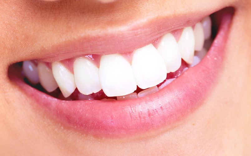 چرا زیبایی دندانها ضروری است؟