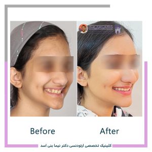 نمونه ارتودنسی ثابت شماره 123